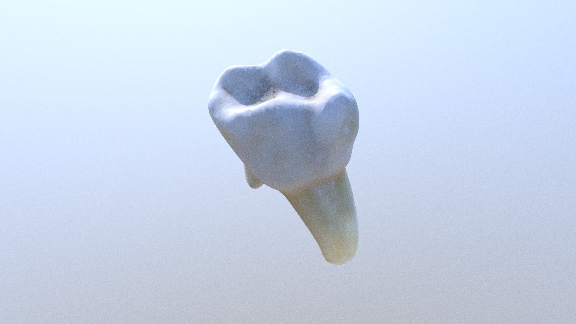 UD4 Tooth - 3D model by agudmartinez [041aafa] - Sketchfab