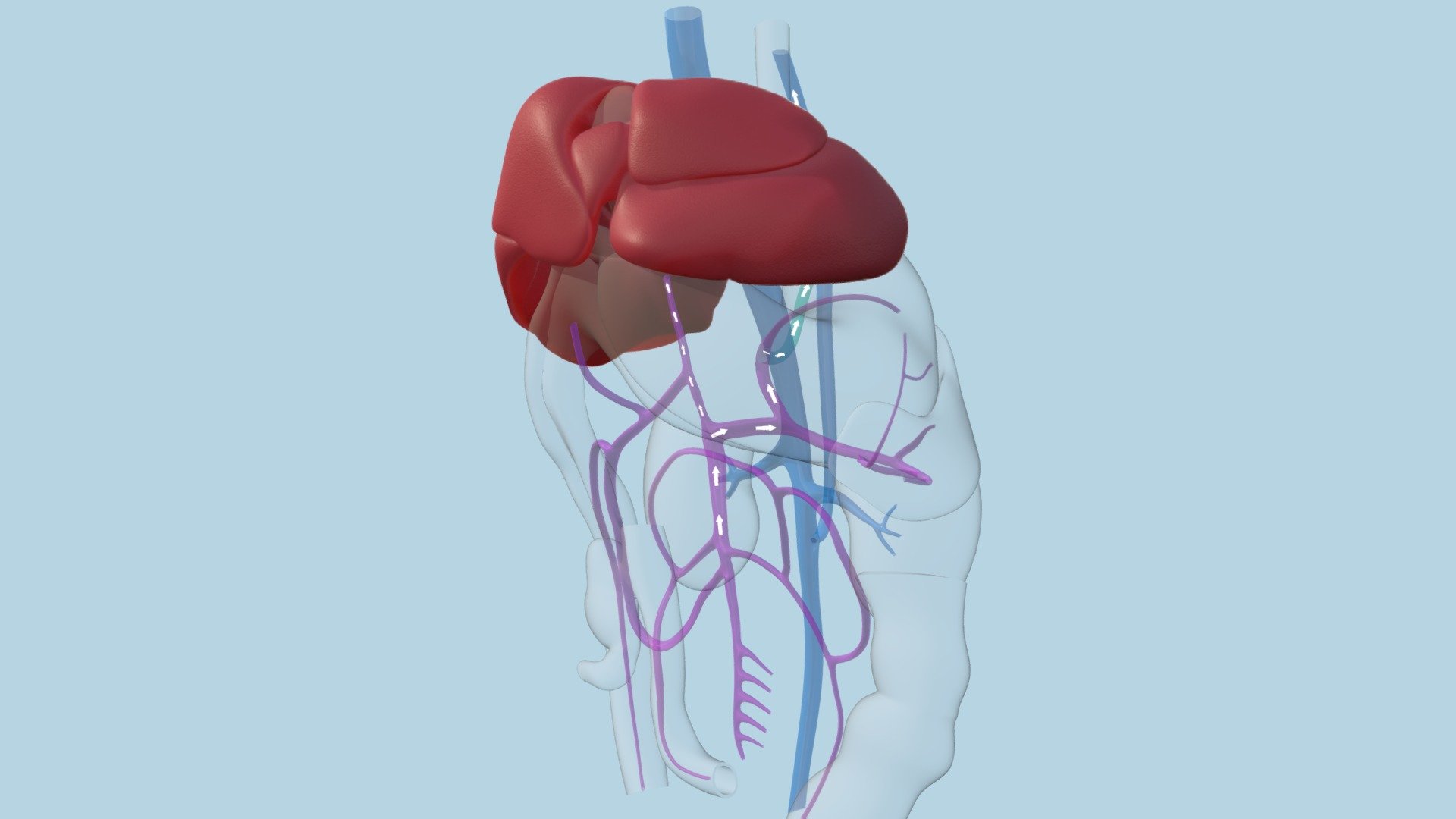 Gastric vein to azygous vein shunt - 3D model by ERC [0437c6f] - Sketchfab