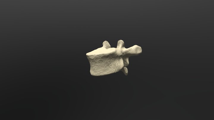 Thoracic vertebra T5 3D Model