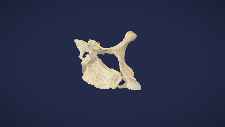 7. Halswirbel (C7) - 7th cervical vertebra 3D Model