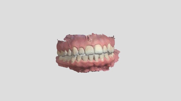 Dental Arches KL 3D Model