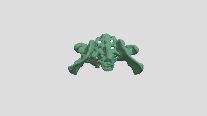 Exam 3 - Pelvis 3D Model