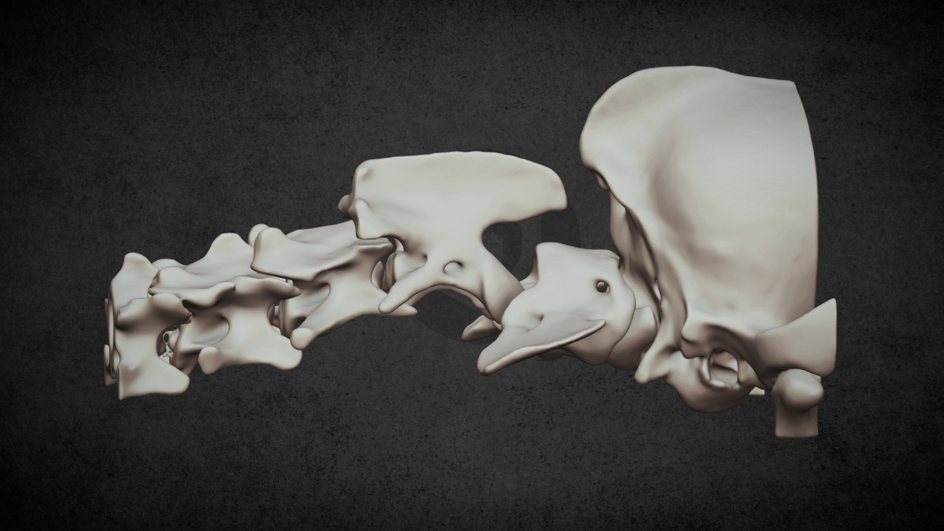 Atlantoaxial instability (ID5556) - 3D model by LimesVet [055335d ...