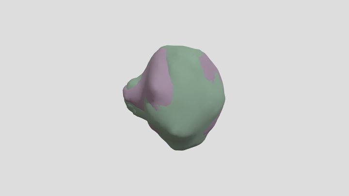 Tumors Segs 3D Model