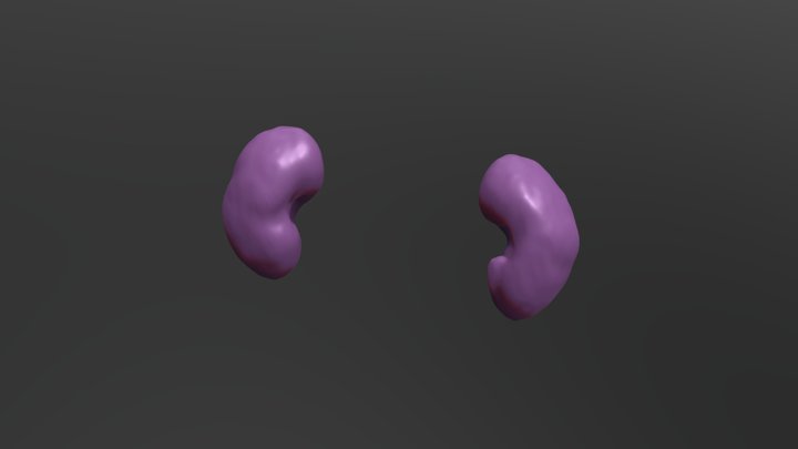 Segmentation_Kidney 3D Model