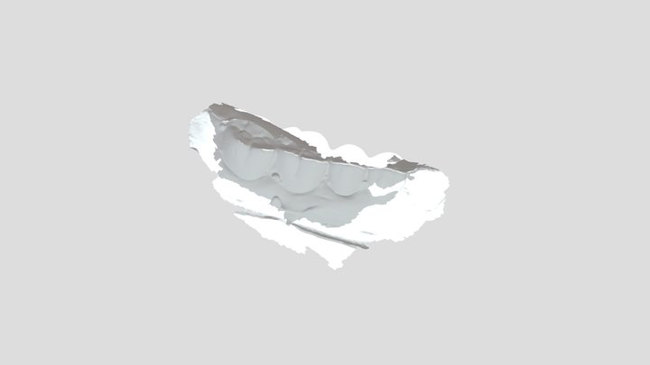 2022-05-26 001 031- Upper Jaw 3D Model