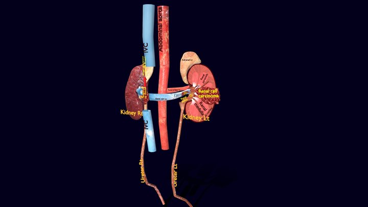 Nephro 3D models - Sketchfab