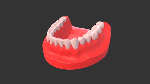 MNR_Dental_Scan 3D Model