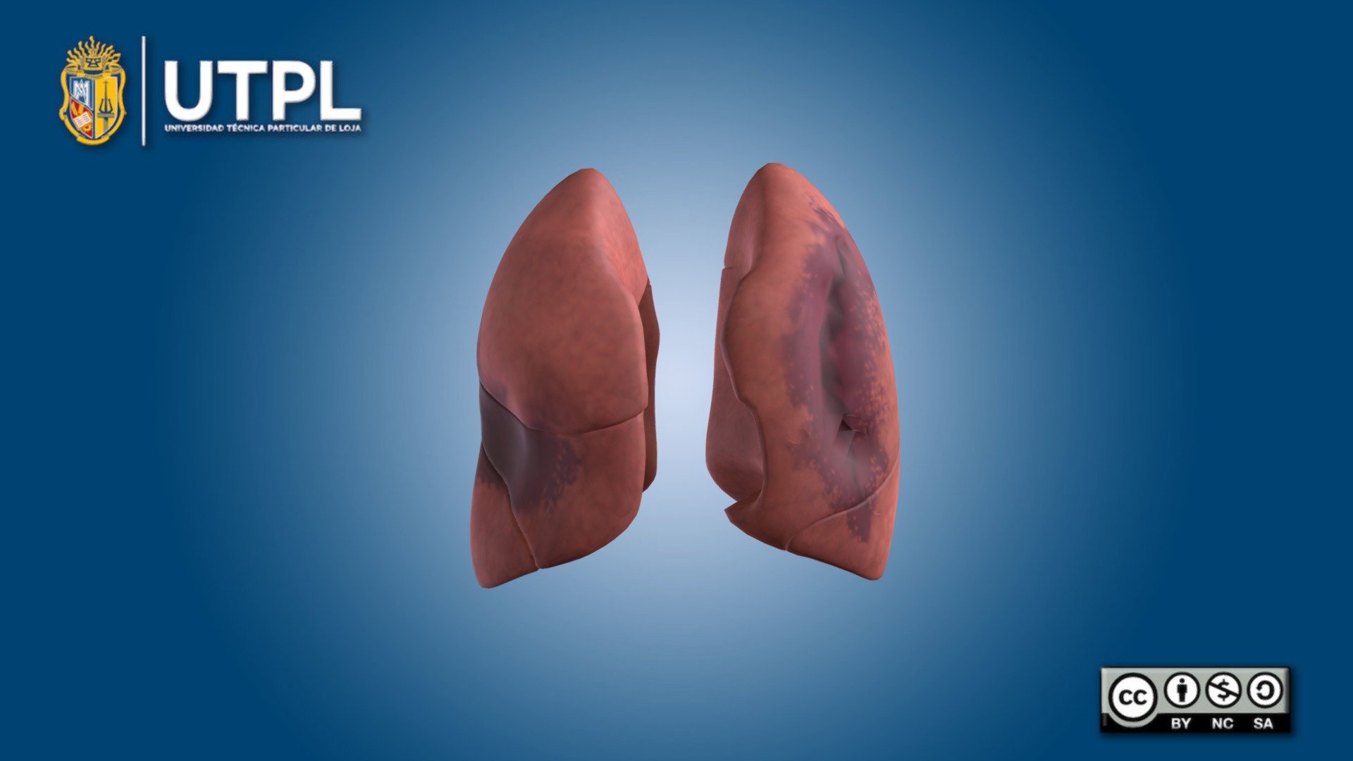 Pulmones Atropellado