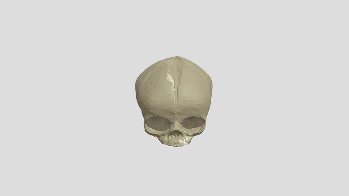 Human_Fetal_Skull 3D Model