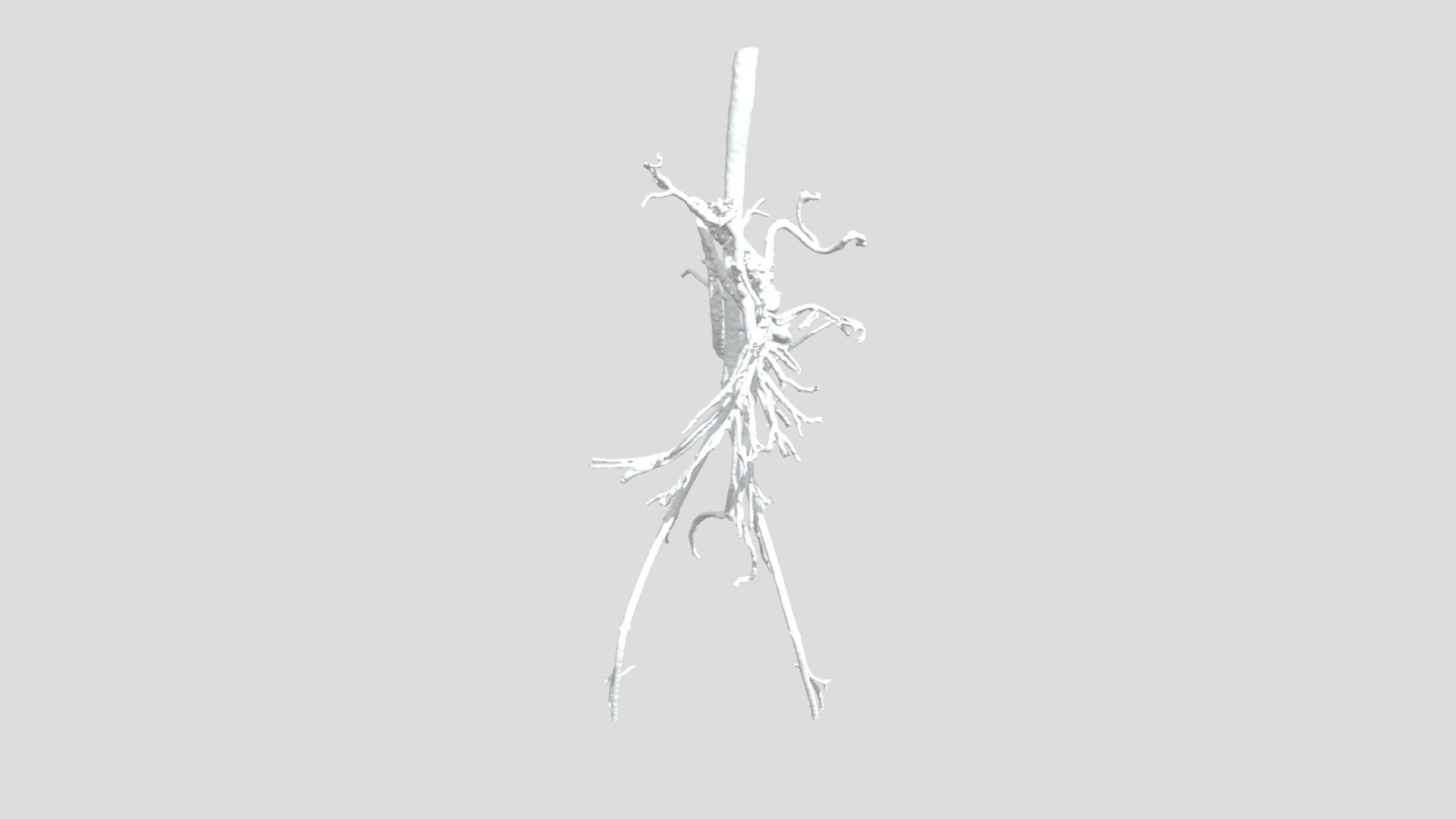 Congenital, cardiovascular disorder