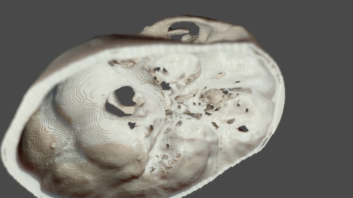 Skull base CT 3D Model