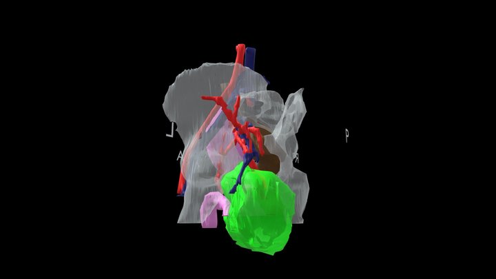 Radiology 3D models - Sketchfab