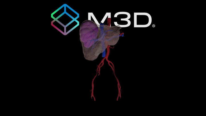 Dr. Zamalloa - Px Baquedano - Segmentacion 3D 3D Model