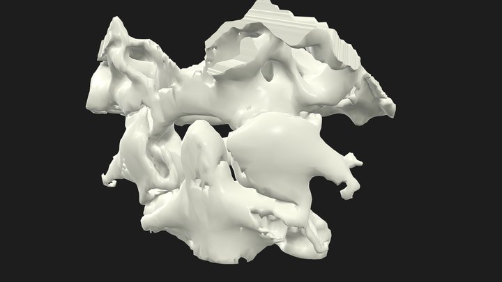C2 Dens Type 2 fracture 3D Model