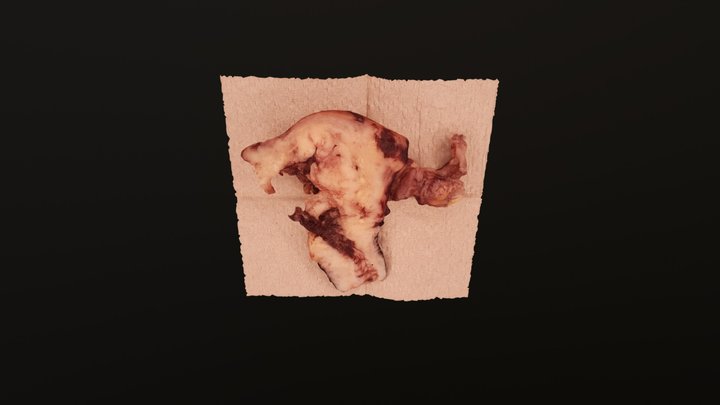 Uterus 5 3D Model