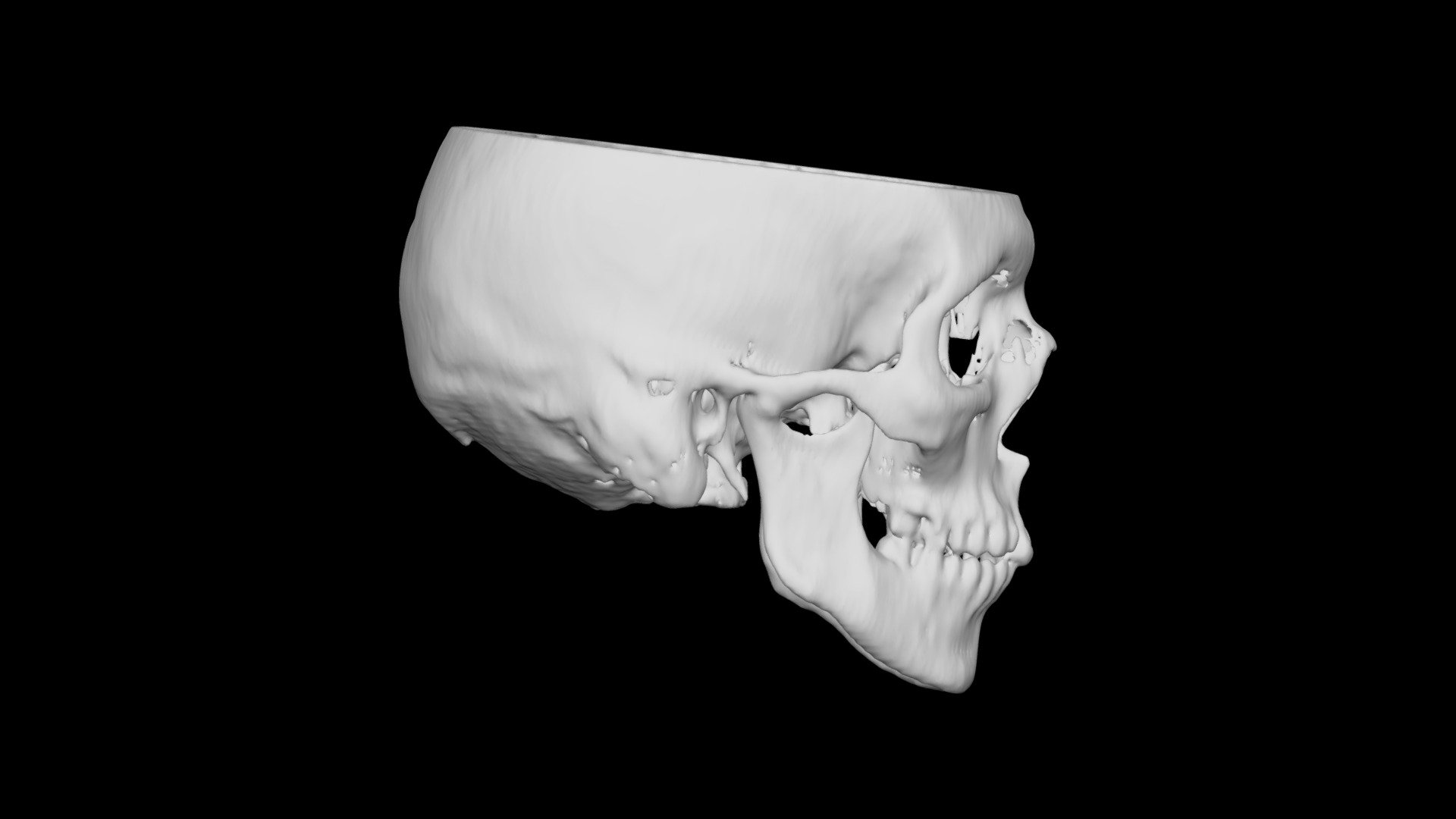 Skull Male 49yo