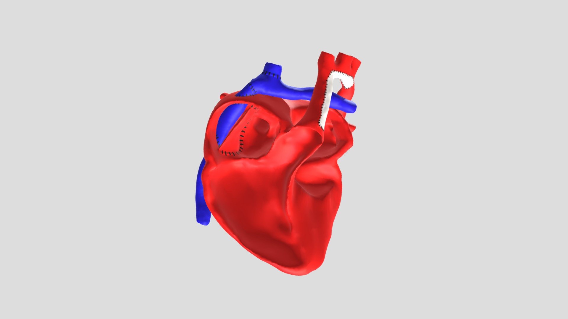 Intracardiac Post Fontan Model - Download Free 3D model by kevburk ...