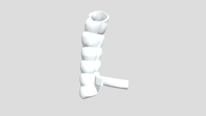 Anastomoz Gorizontalniy 1st Phase 3D Model