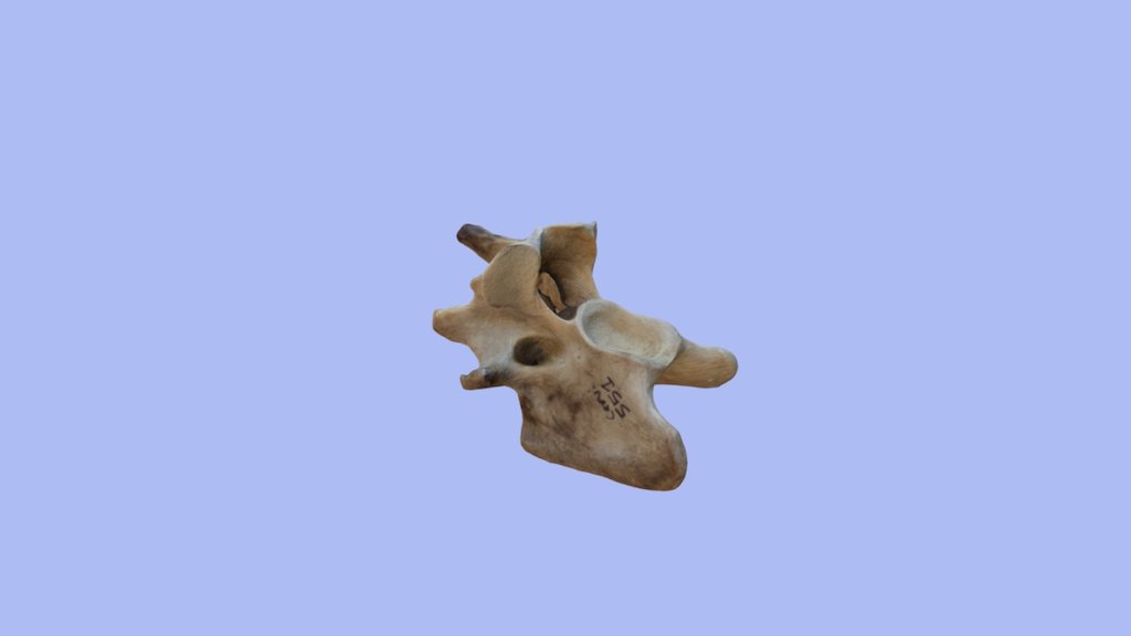 cervical vertebra