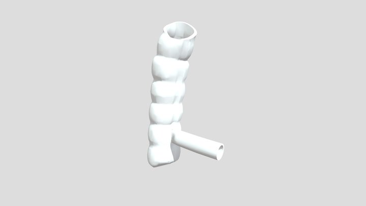 Anastomoz Gorizontalniy S Vibuhaniyem 3D Model