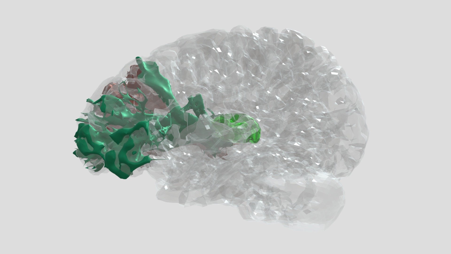 Your Anterior Thalamic Radiations and Thalamus — Sketchfab embed 3D viewer
