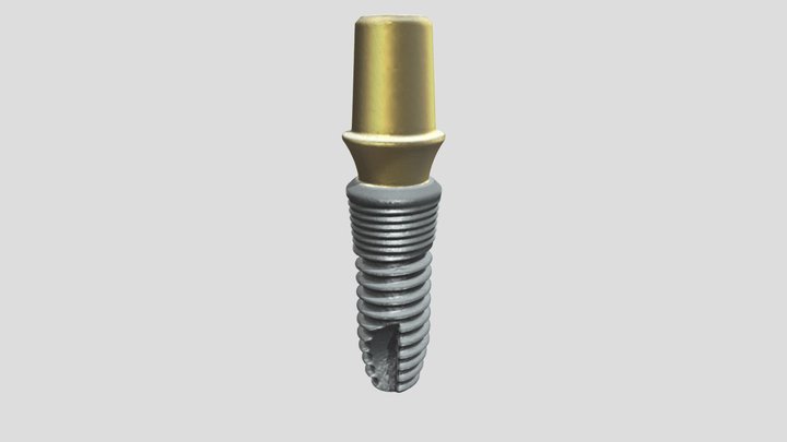 1 Dental Implant 3D Model