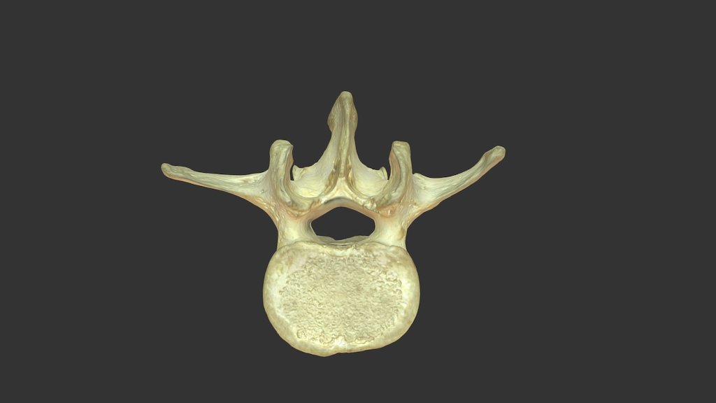 Lumbar Vertebra with Texture - 3D model by Wellesley College ...