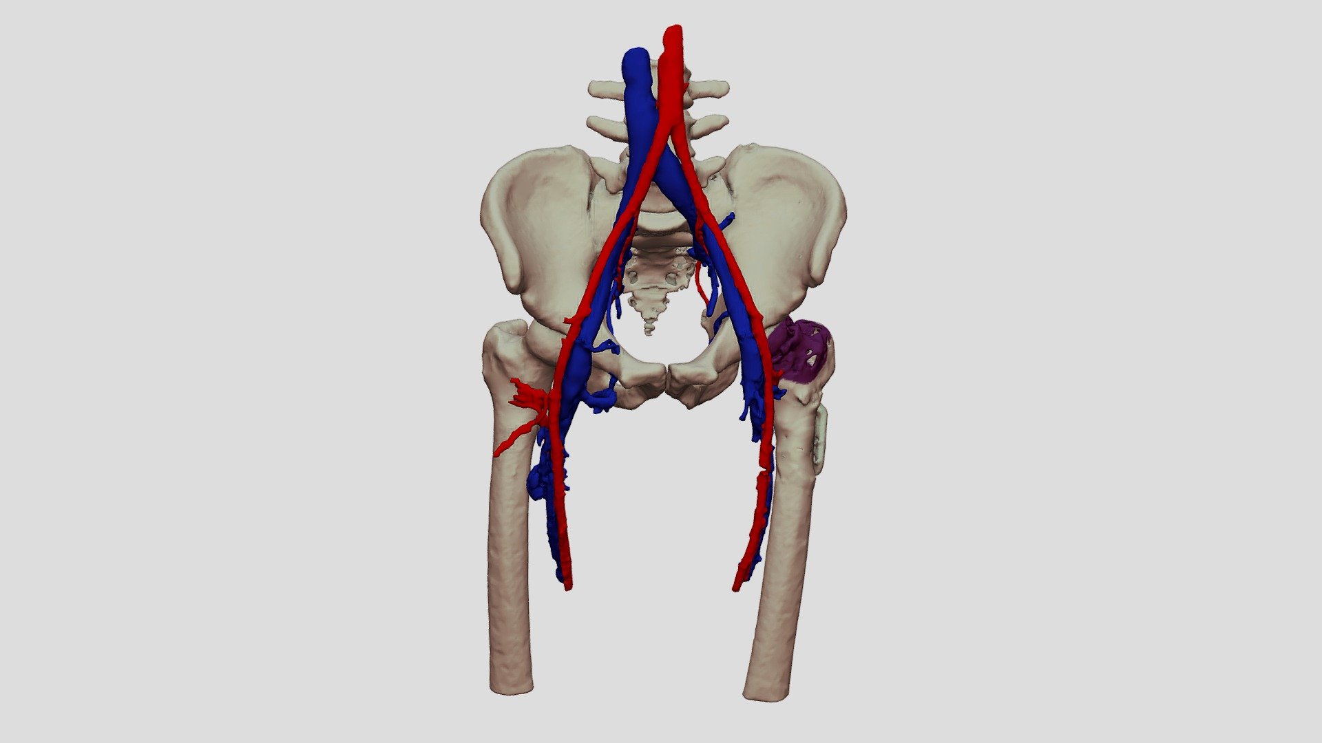 Mess - 3D model by Chair_Digital_Anatomy [0a01927] - Sketchfab