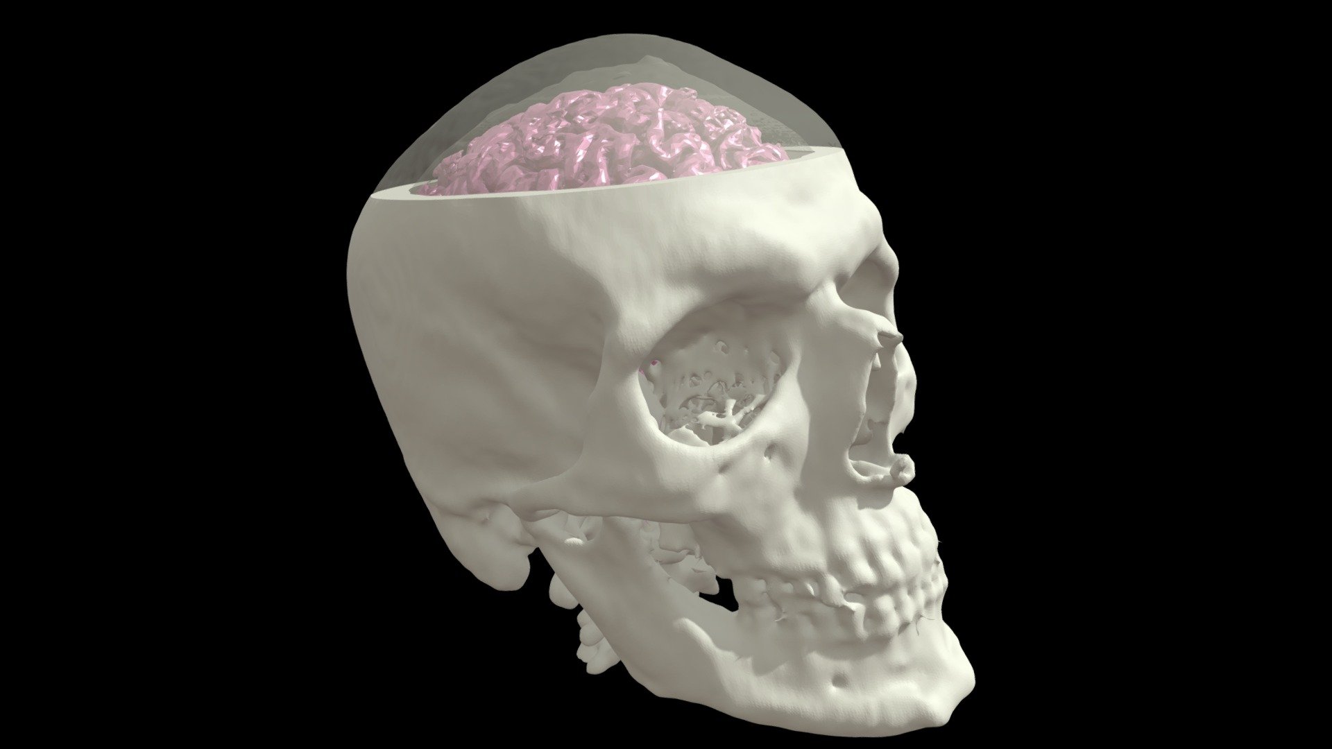 Skull with Brain