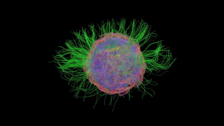 Brain Organoids and Their Role in Prion Disease 3D Model