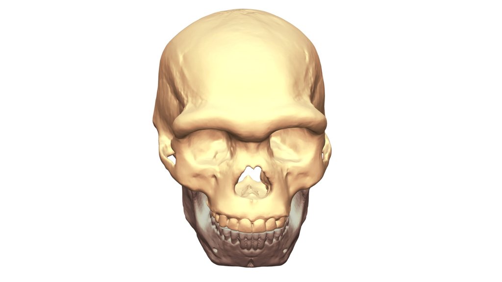 Harbin Cranium Mauer Mandible Reconstruction