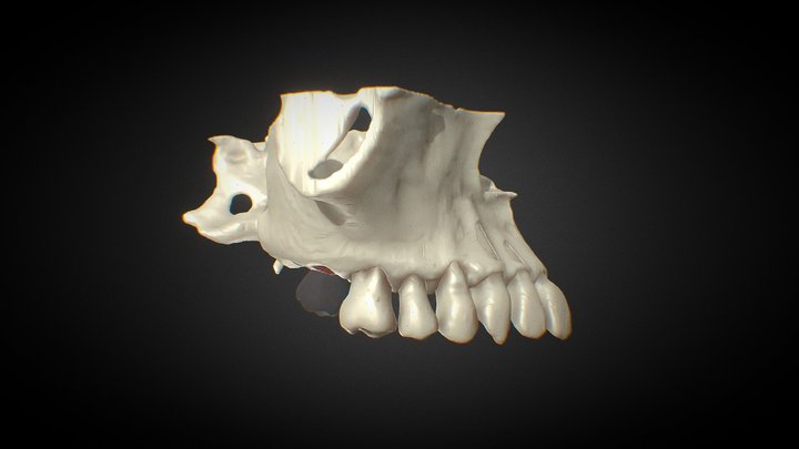 transplantation 18 to 17  By  Zachary Fyi 3D Model