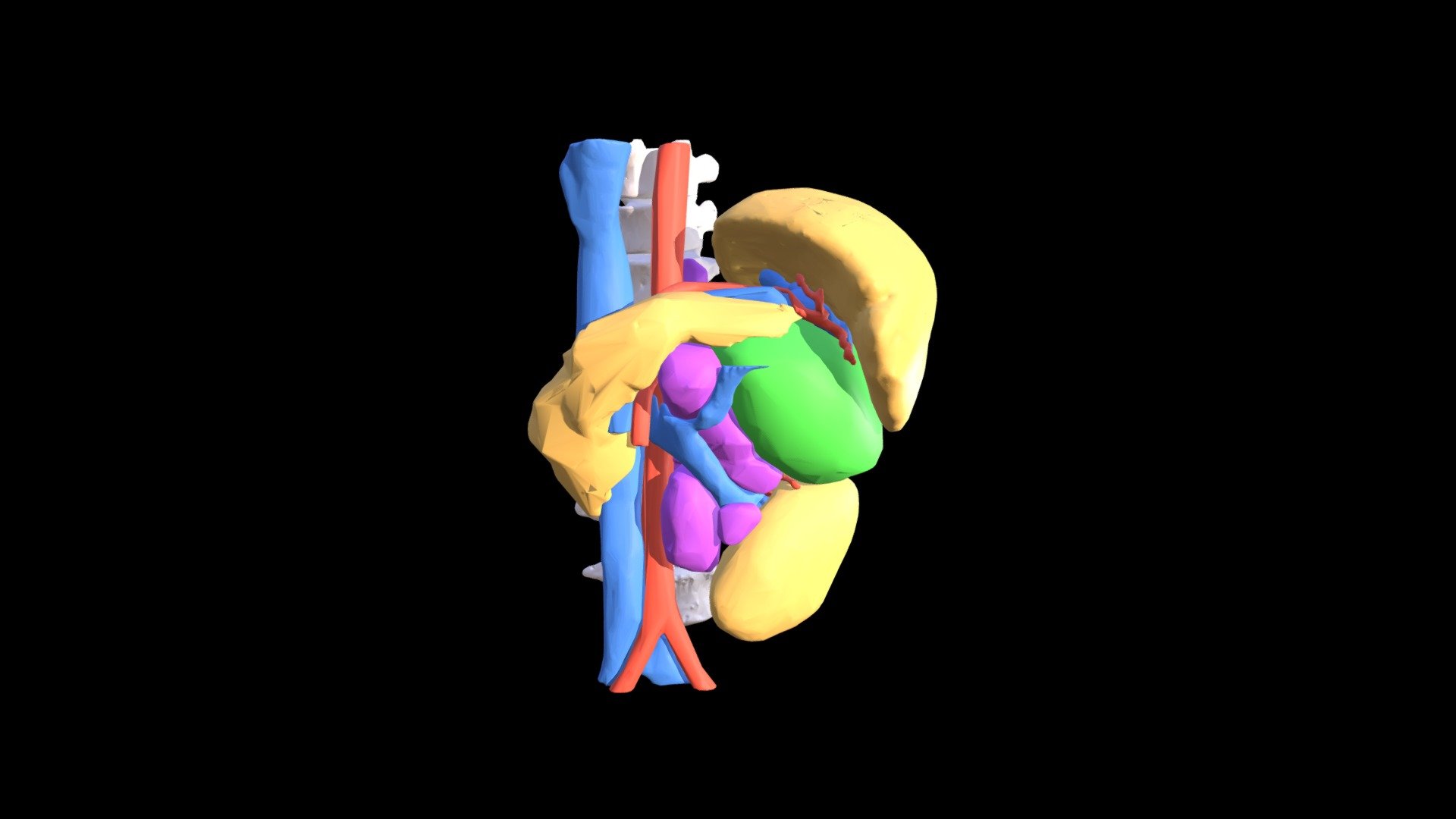 Neuroblastoma 3D model by Lincoln Wong (lincolnwong) [0af3e54