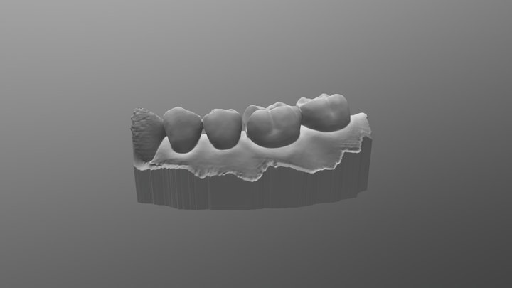 Inlay 3D Model