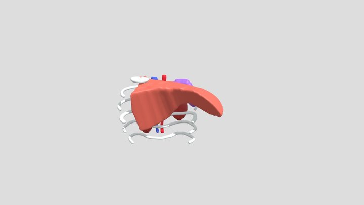 241118-pediatricLDLT-3D-simulation-S2mono 3D Model