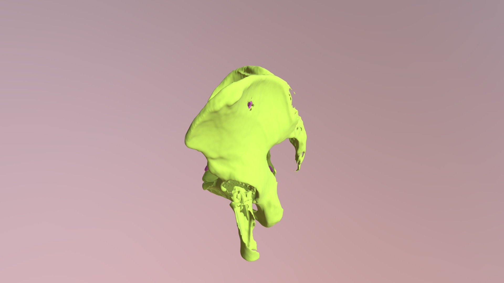 New Pelvis Who Dis