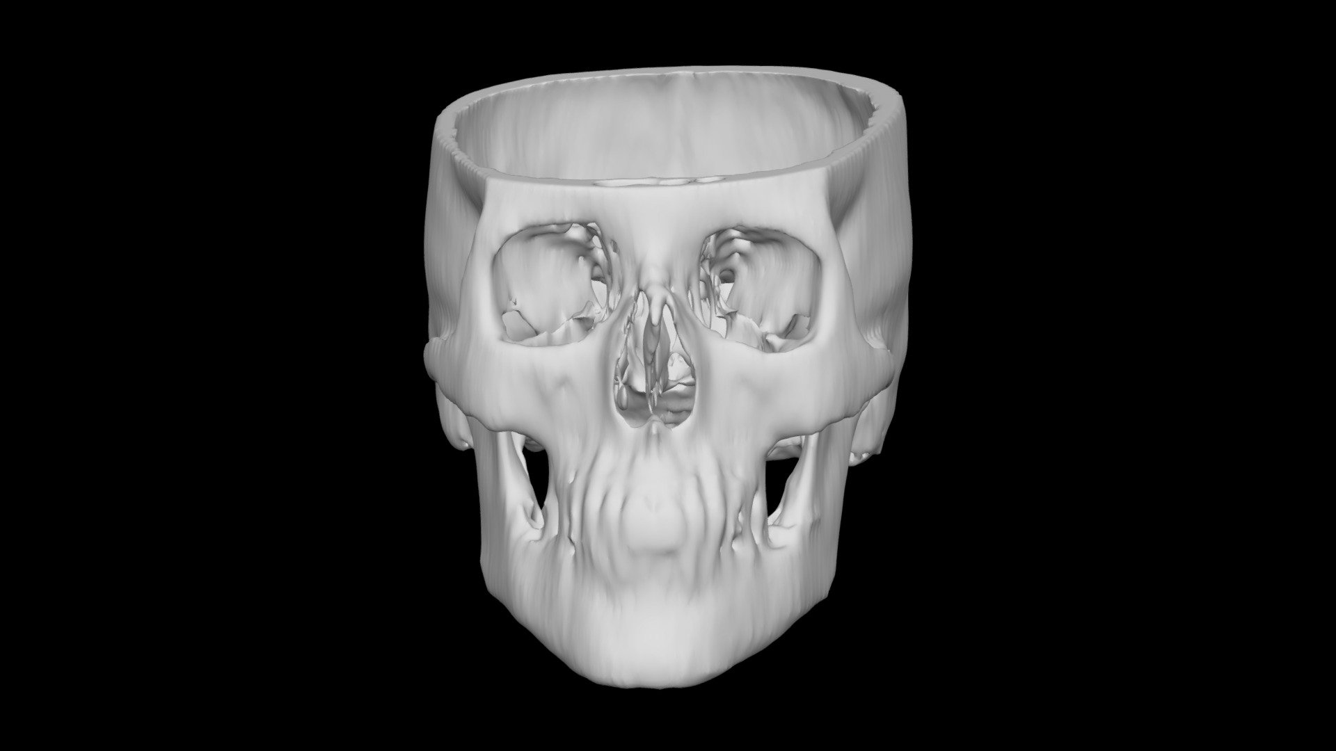 Skull Female 43yo