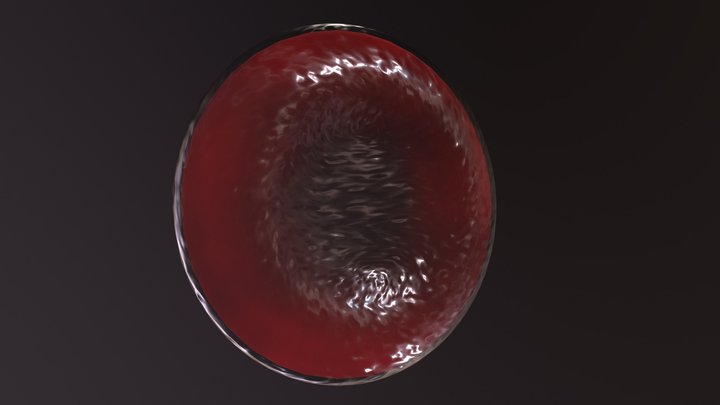 Iron-Deficient Red Blood Cell 3D Model