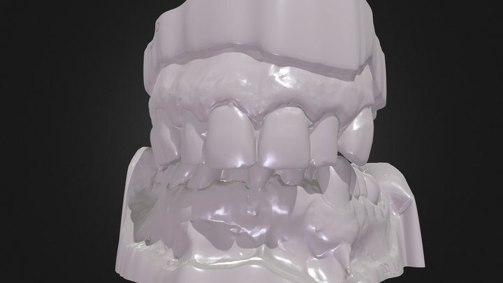 Occlusion Case OO 3D Model