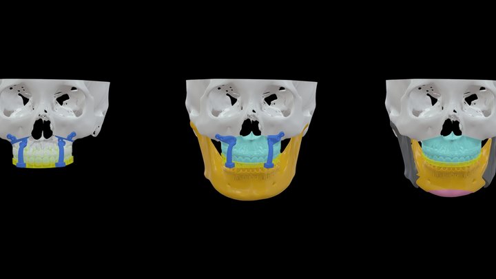 Dr_許-李O善-0211 3D Model