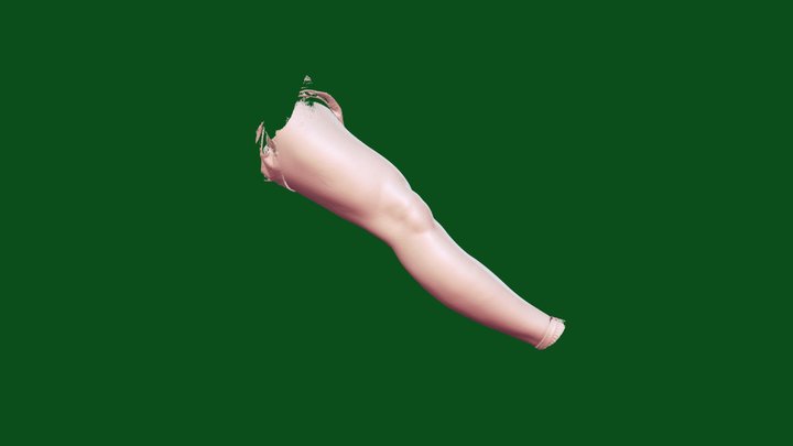Leg