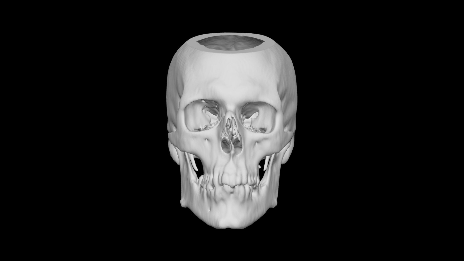 Skull Male 49yo