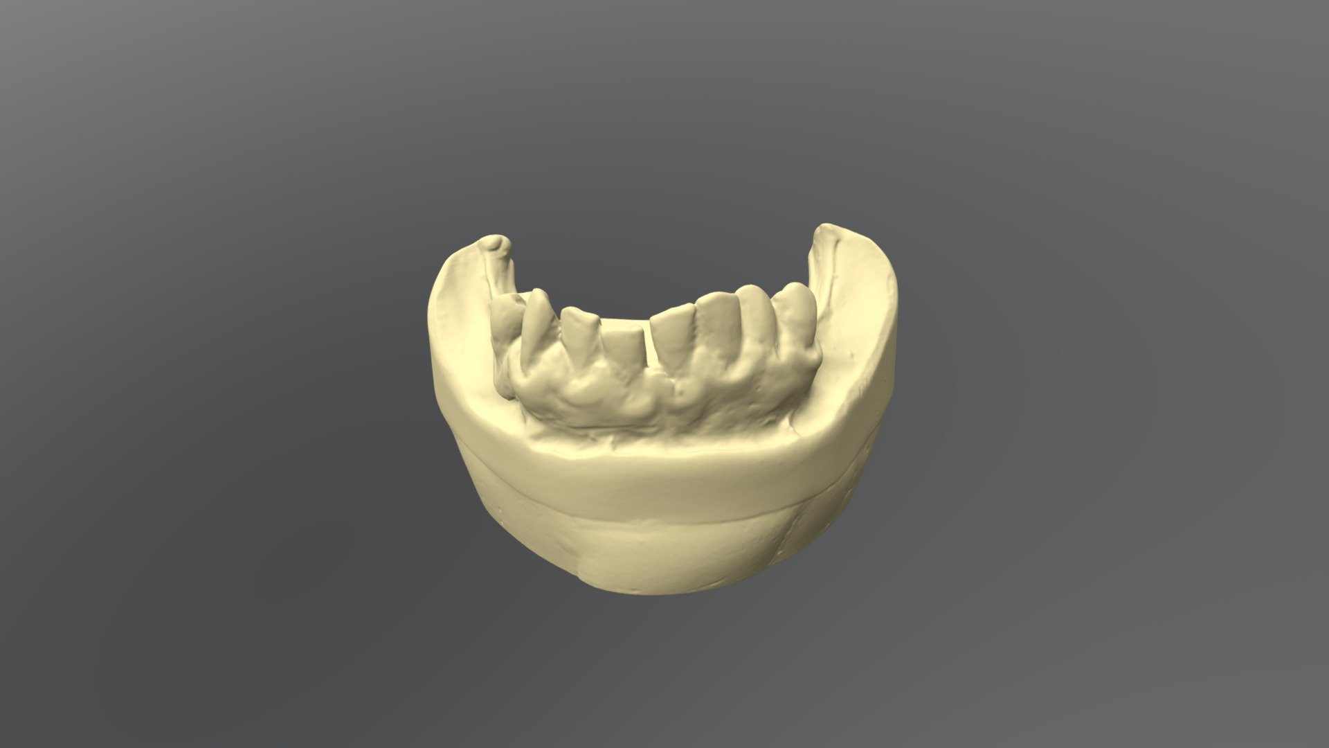 W4 C1 Lower