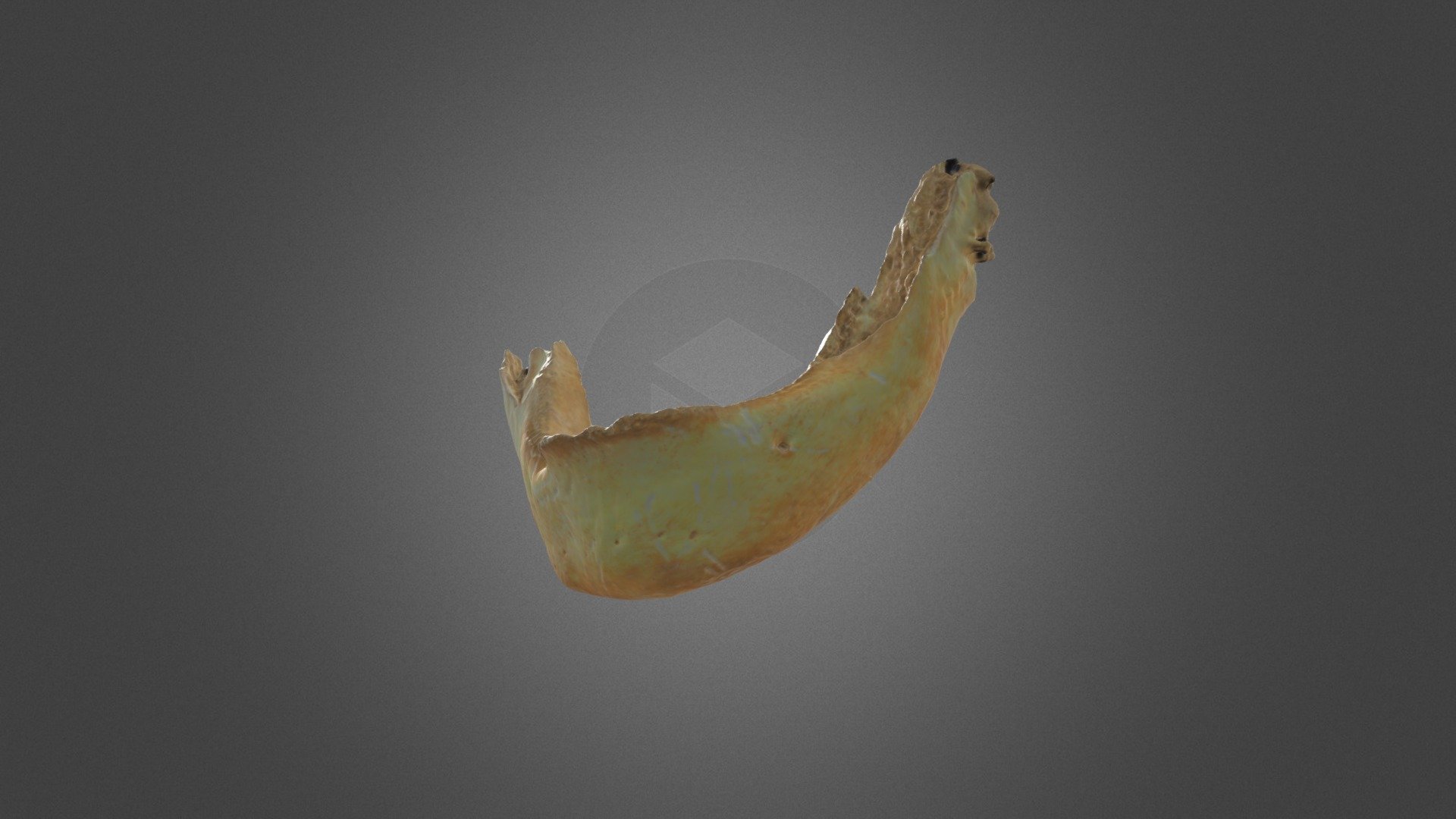 Bone 5