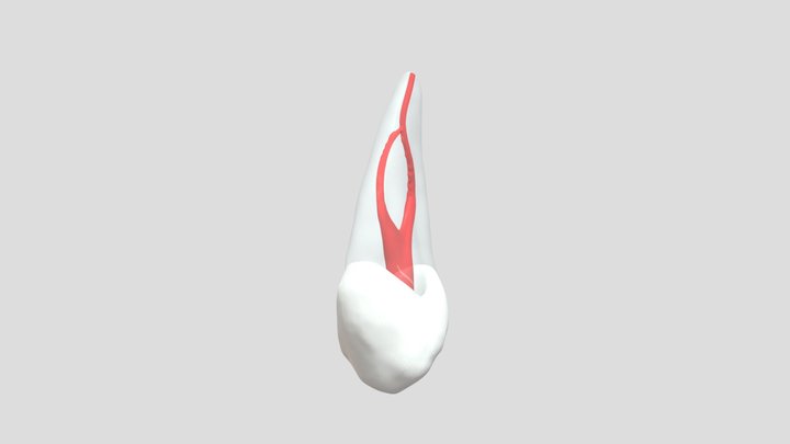 Endodontic #24 3D Model