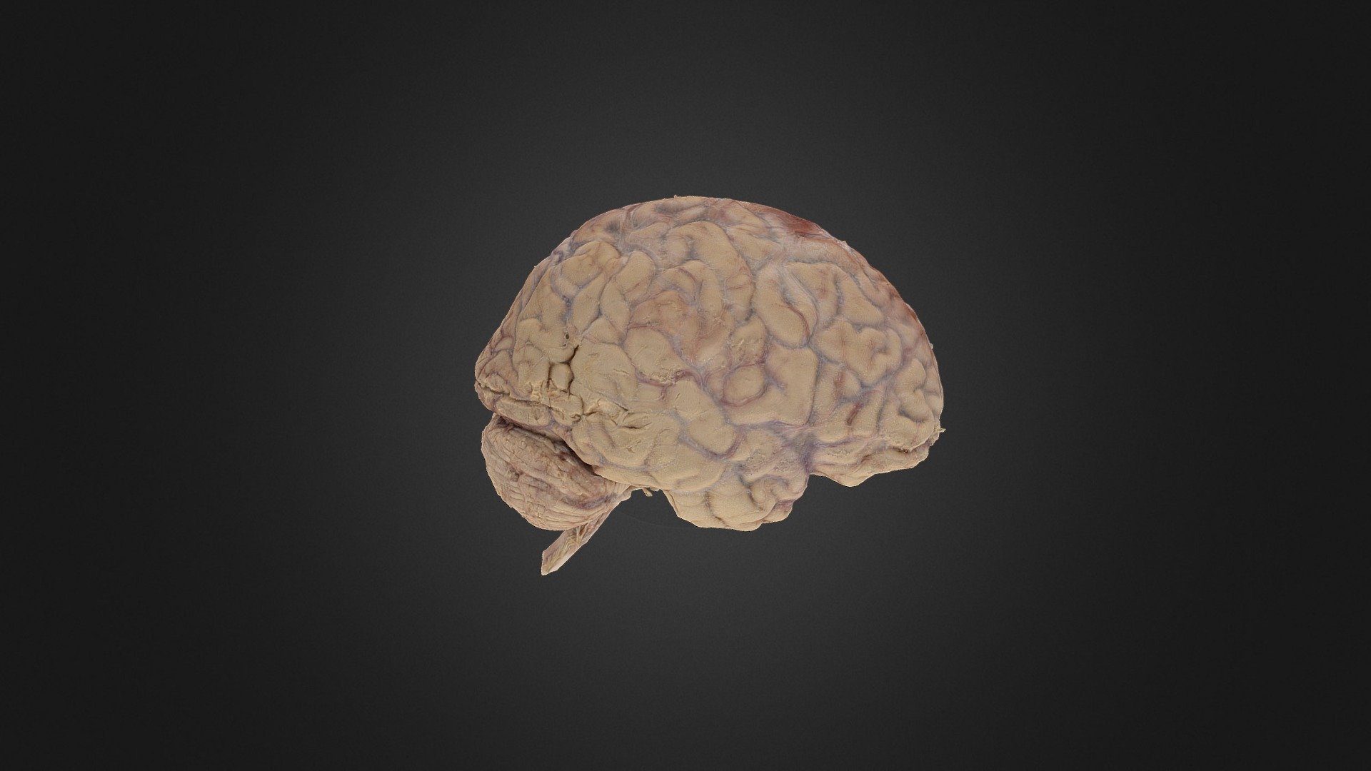 Brain High Dense Cloud Version