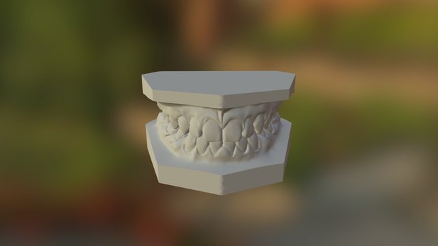 有拔牙完成 3D Model