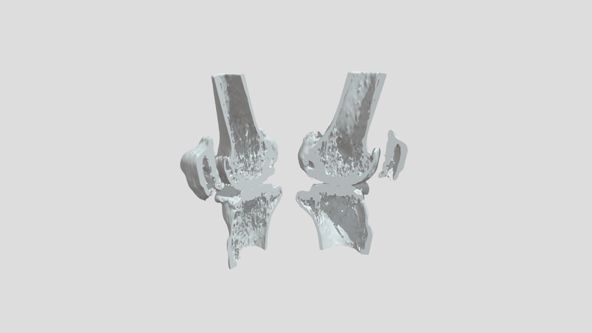 Segmentation Segment Bklt Bone