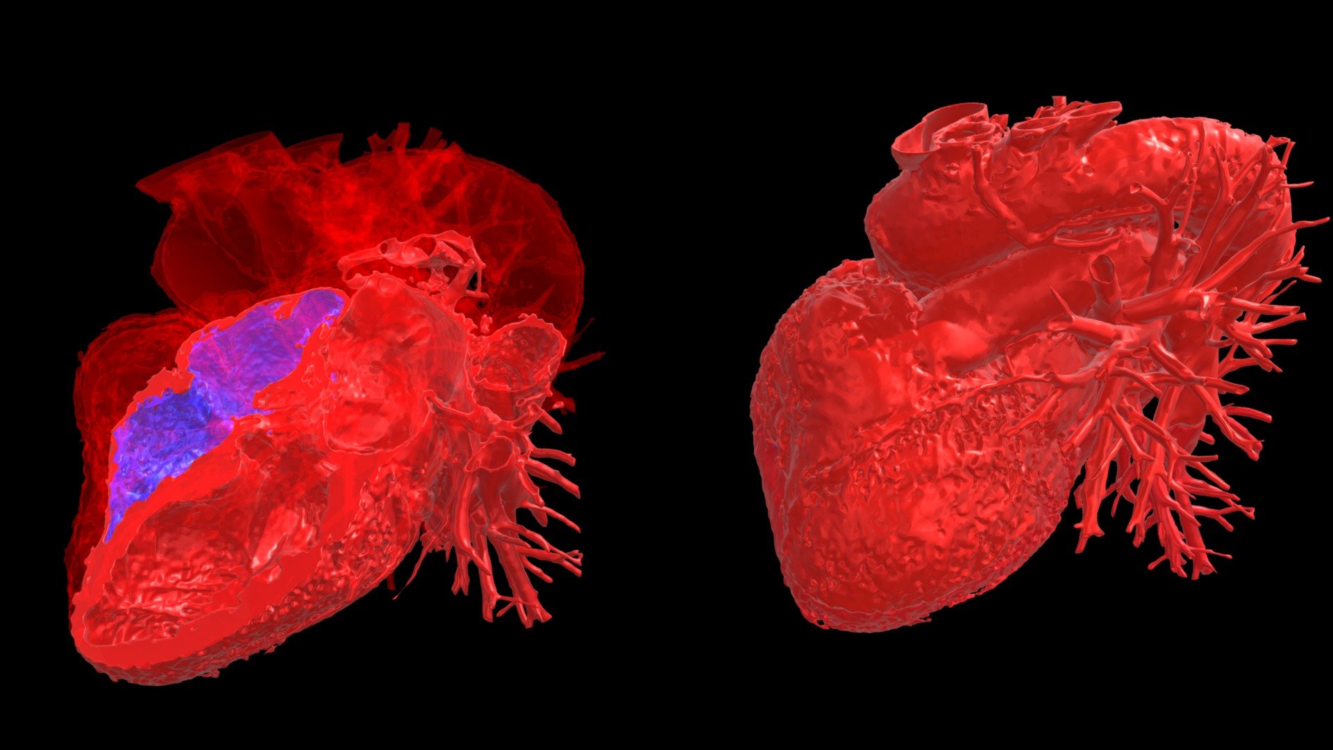 Human Heart from CT Scan